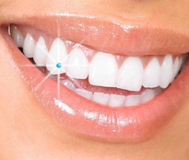 dental jewellery